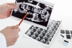 When Is a Bone Graft Recommended for Dental Implants?