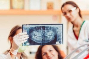 Why Get Dental X-rays Before Implant Surgery?